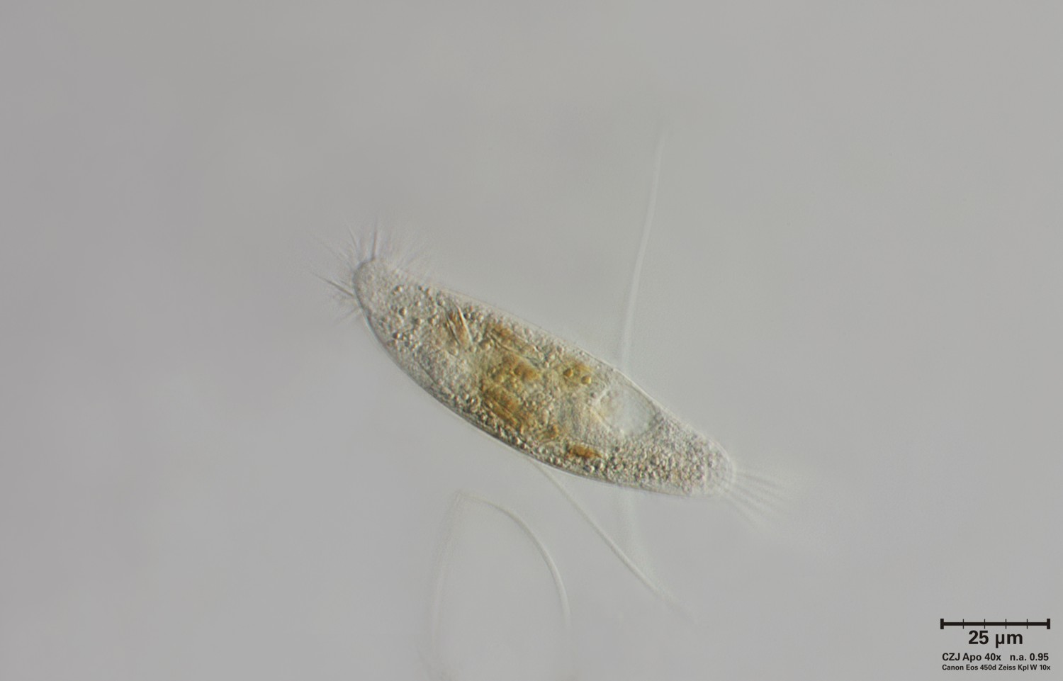 Ciliato non meglio identificato
